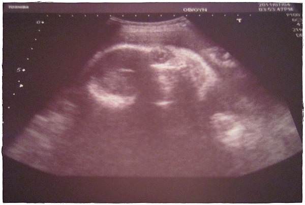 29W-1