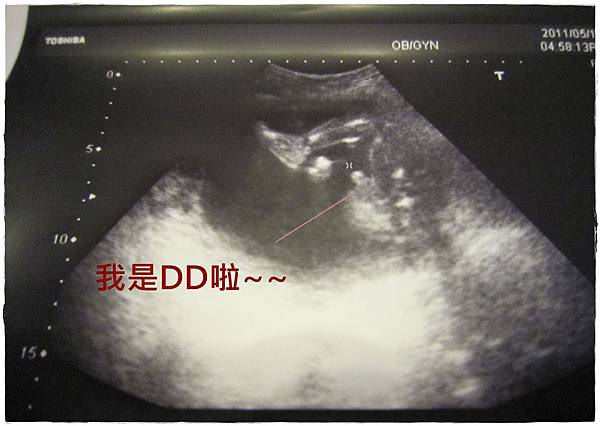 22W－2