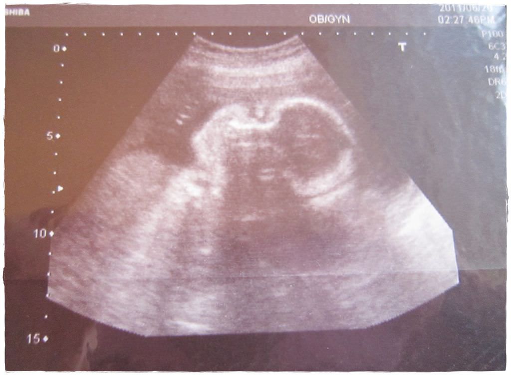 27W-1