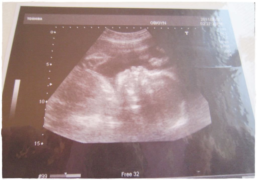27W