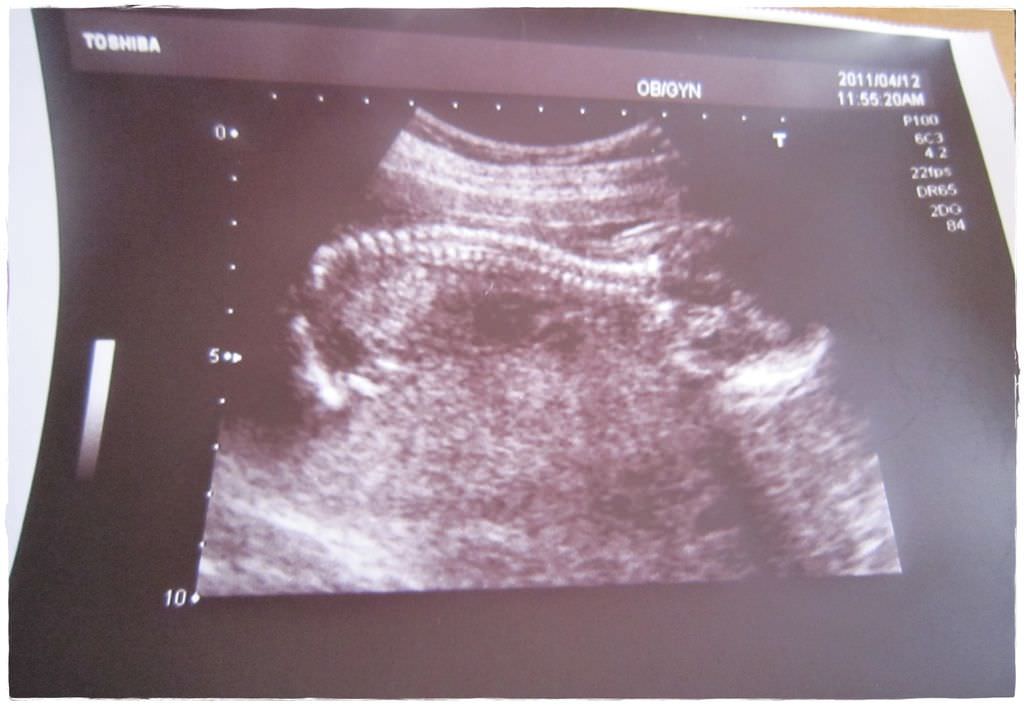 17w-2
